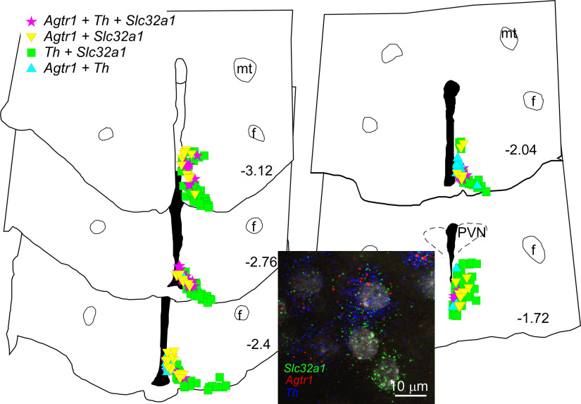 Figure 18.