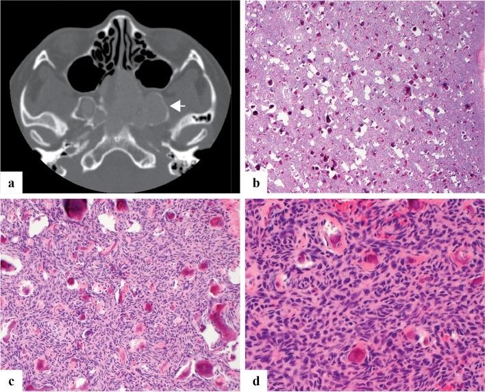 Fig. 3