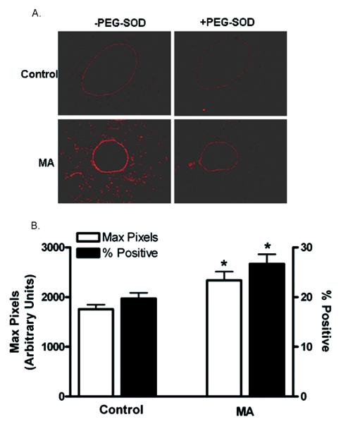 FIG. 6