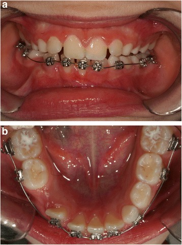 Fig. 3