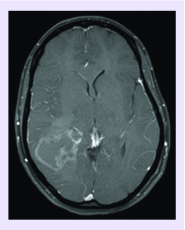 <b>Figure 1.</b>