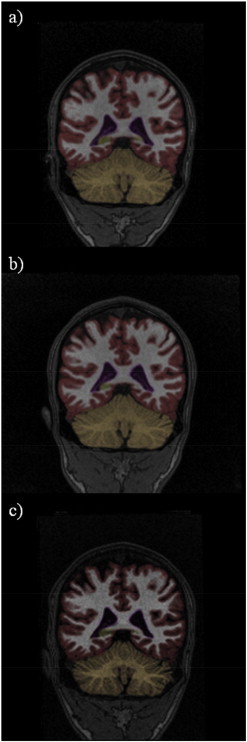 Fig. 2