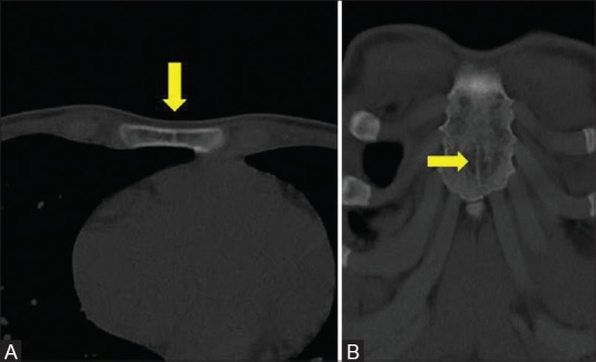 Figure 14 (A and B)