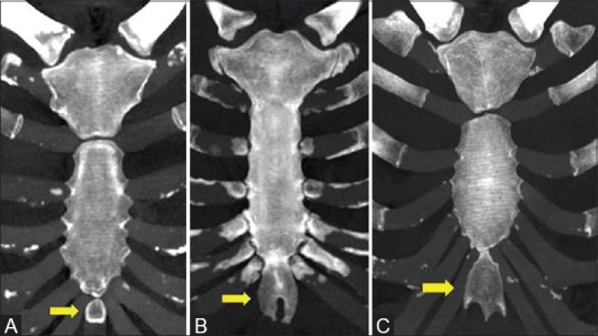 Figure 18 (A-C)