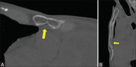 Figure 16 (A and B)