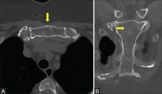 Figure 15 (A and B)