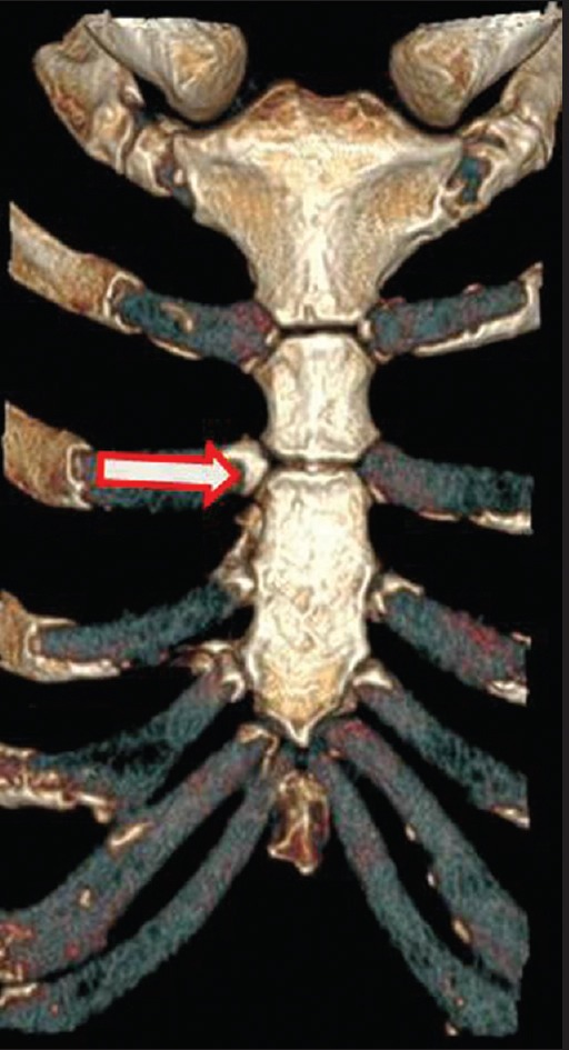 Figure 25