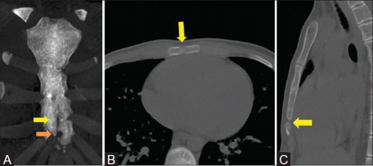 Figure 13 (A-C)