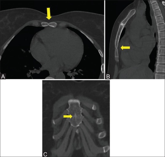 Figure 17 (A-C)