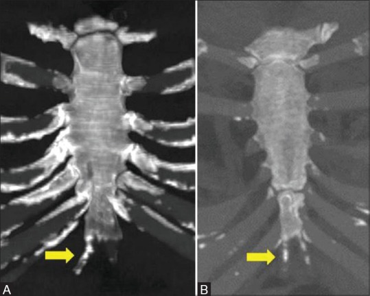 Figure 22 (A and B)