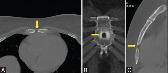 Figure 10 (A-C)