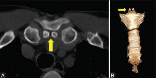 Figure 4 (A and B)