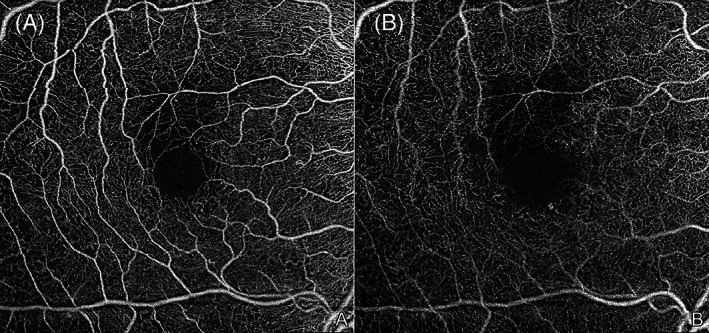 FIGURE 11