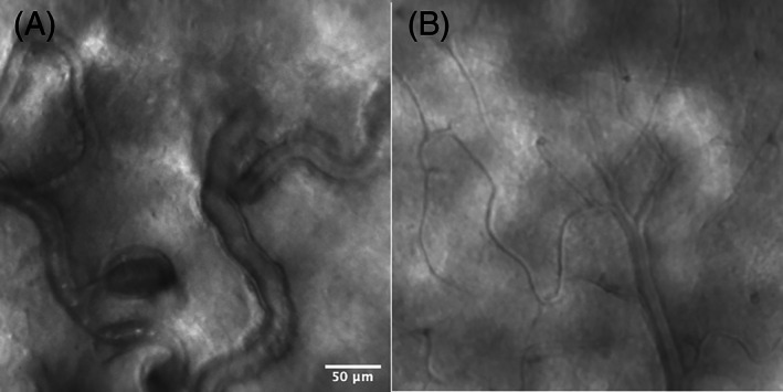 FIGURE 14