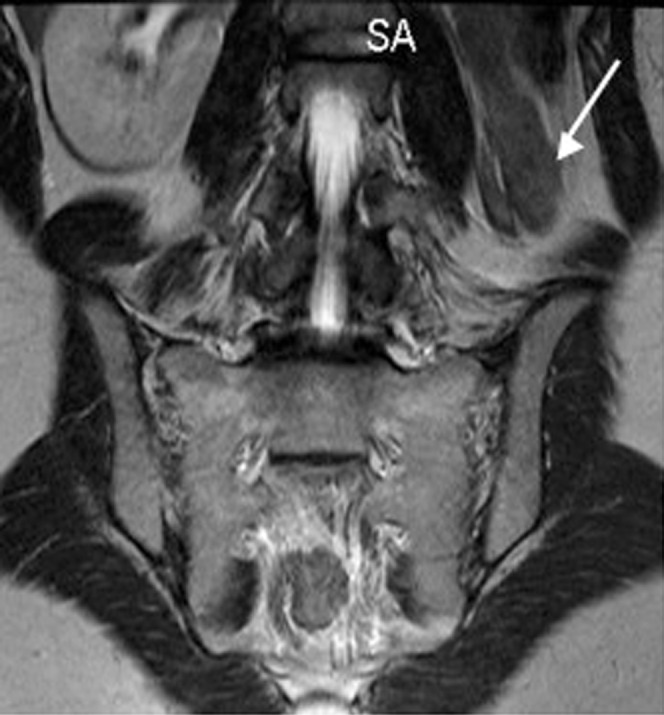 Figure 13.