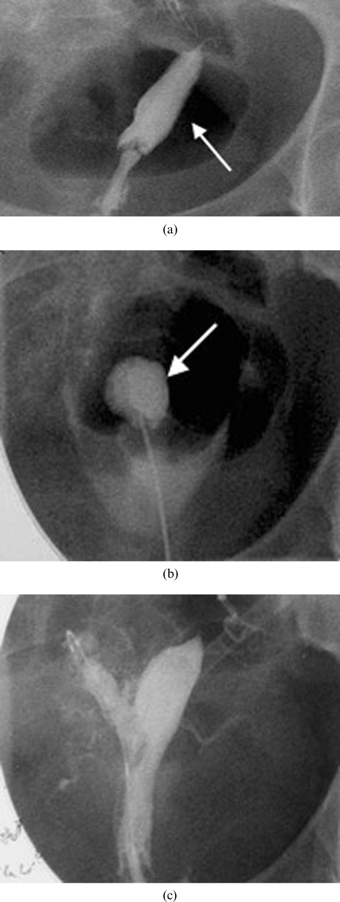 Figure 14.