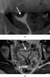Figure 11.