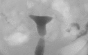 Figure 12.