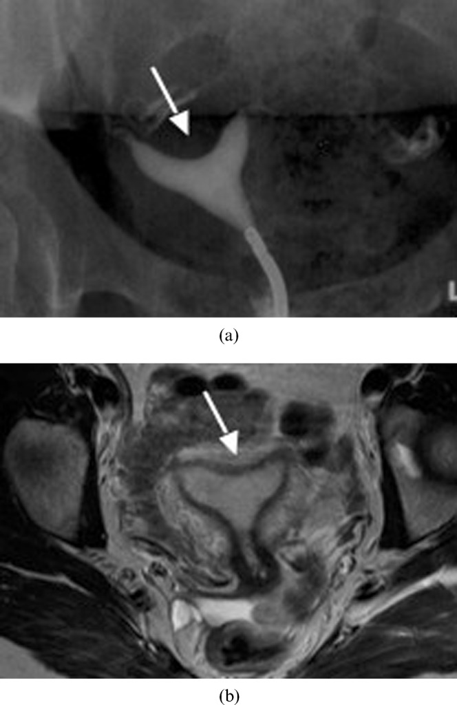 Figure 11.