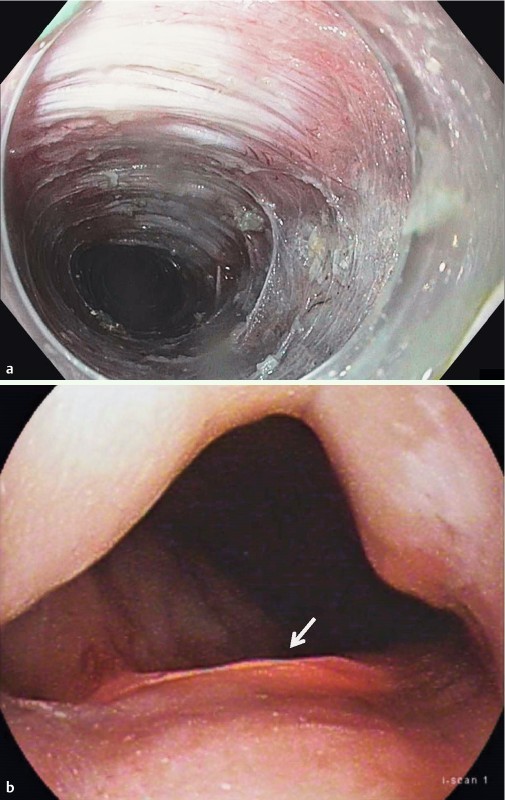 Fig. 2