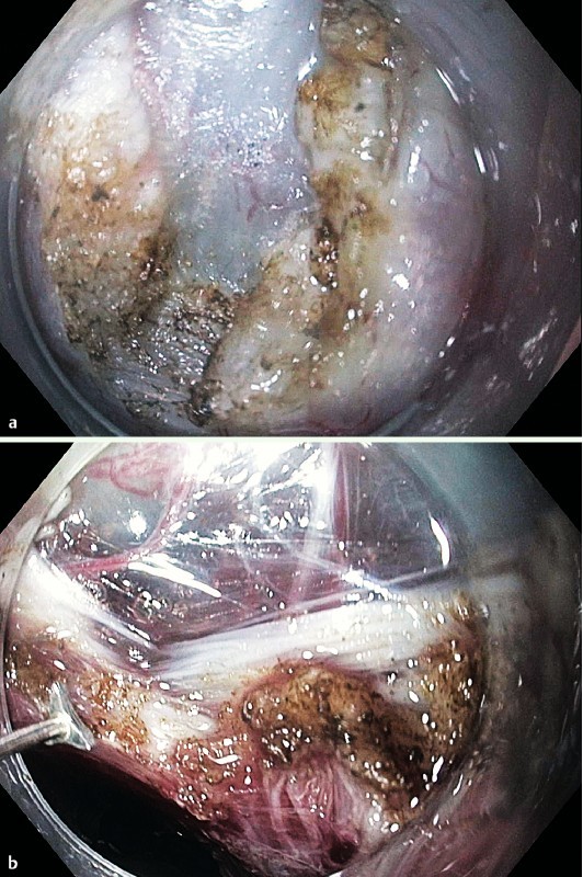 Fig. 3