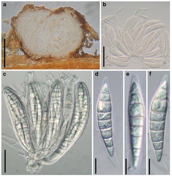 Fig. 32