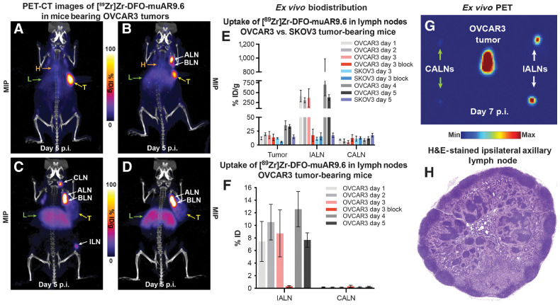 Figure 2. ImmunoPET imaging and ex vivo biodistribution data delineate lymph node involvement in mice bearing OVCAR3 xenografts. A–D, Maximum intensity projection (MIP) PET-CT images (scaled 0–100) of mice with subcutaneous OVCAR3 xenografts acquired 5 days after the intravenous administration of 1.2 ± 0.1 mg/kg of [89Zr]Zr-DFO-muAR9.6 (255 ± 49.5 μCi; 9.4 ± 1.8 MBq; 29.6 ± 2.0 μg) showing differing distributions of radioactivity. Heterogeneous patterns of uptake are evident in the tumor (T), lymph nodes (ALN = axillary lymph node; BLN = brachial lymph node; CLN = cervical lymph node; ILN = inguinal lymph node), blood (indicated by the heart, H), and liver (L). E, Ex vivo biodistribution data comparing the radioactivity concentrations (%ID/g) in the IALNs, CALNs, and subcutaneous tumors of the tumor-bearing mice whose biodistribution data were reported in Fig. 1F. F, Graph comparing the percentage of total injected dose (%ID) values for the IALN and CALN at 5 d p.i. in the OVCAR3 tumor-bearing mice whose biodistribution was shown in Fig. 1F. G, Ex vivo MIP PET image of the tumor, IALNs, and CALNs collected from an OVCAR3-bearing xenograft 7 days after the administration of 1.2 ± 0.1 mg/kg of [89Zr]Zr-DFO-muAR9.6 (255 ± 49.5 μCi; 9.4 ± 1.8 MBq; 29.6 ± 2.0 μg). H, H&E-stained IALN from mouse depicted in Fig. 2D revealing no signs of overt infiltration by neoplastic cells. Detailed sets of %ID/g and %ID values are provided in Supplementary Tables S3 and S4. The maximum intensity projections have been scaled from 0% to 100%.