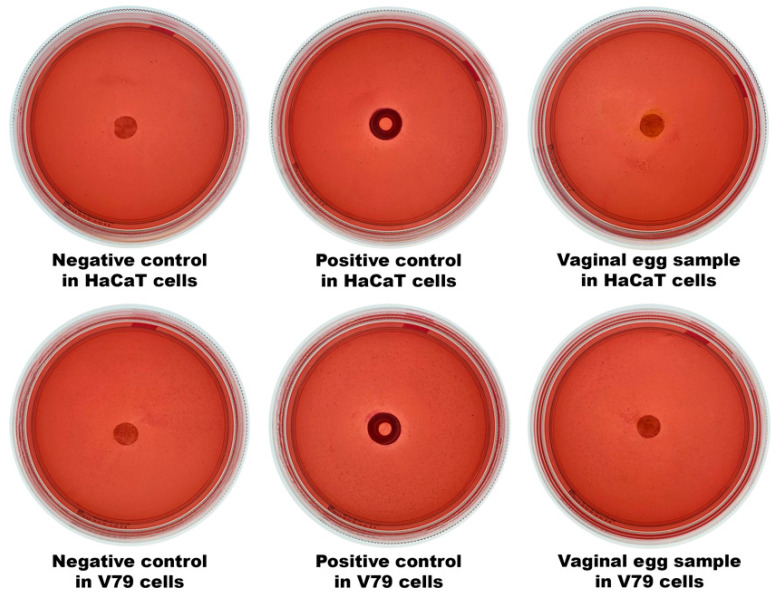 Figure 17