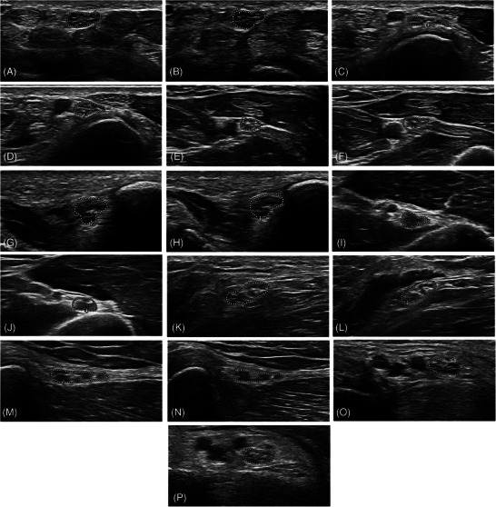 FIGURE 4