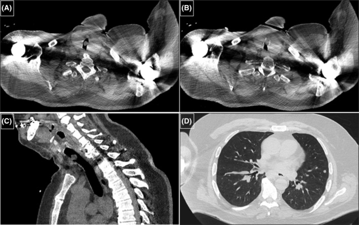 FIGURE 1