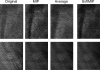 Fig 8.