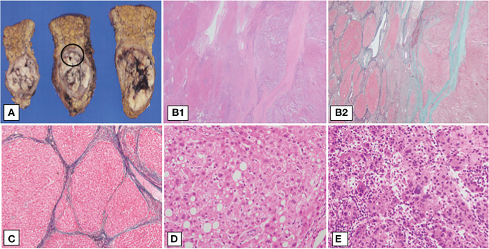 Figure 3