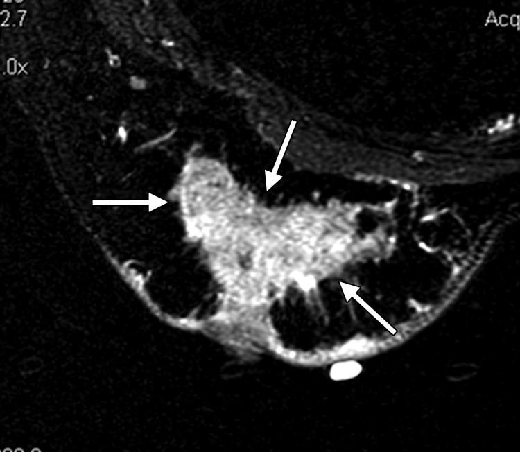 Figure 2a: