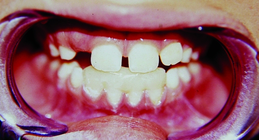 Figure 2b