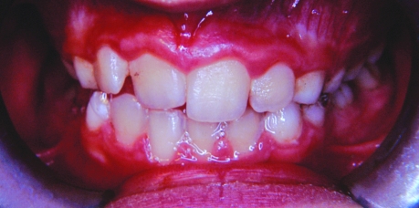 Figure 3c