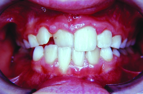 Figure 3a