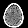Fig 1.
