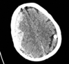 Fig 2.