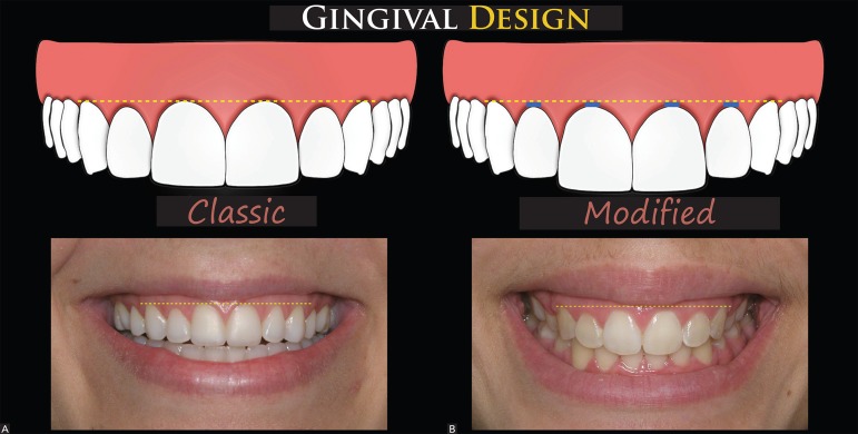 Figure 18