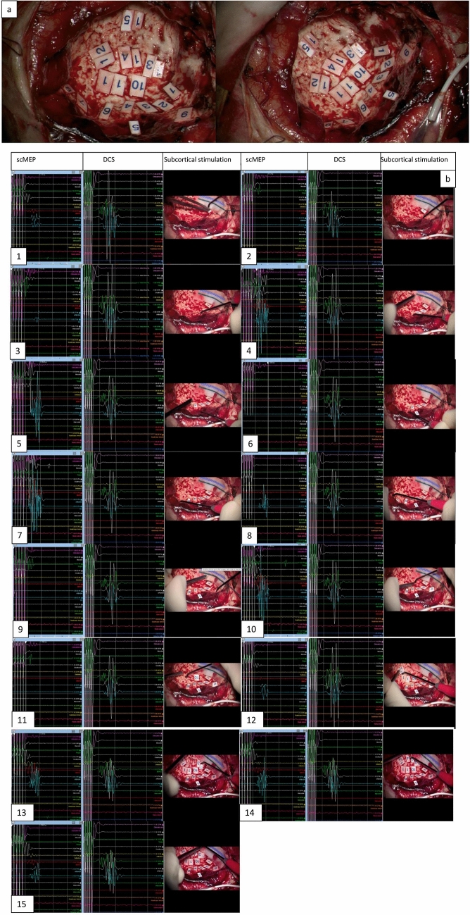 Fig. 2