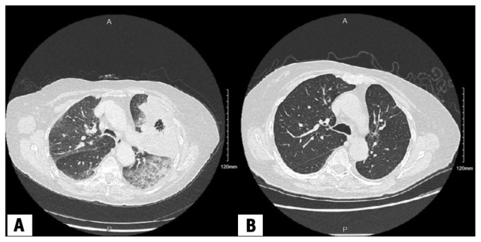 Figure 2: