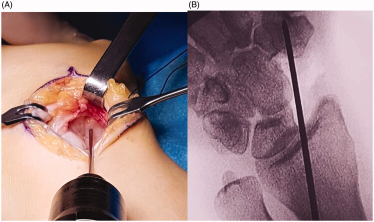 Figure 2.