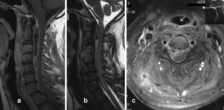 Fig. 2