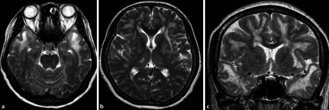 Fig. 12