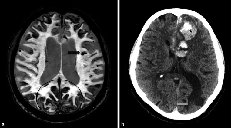 Fig. 11