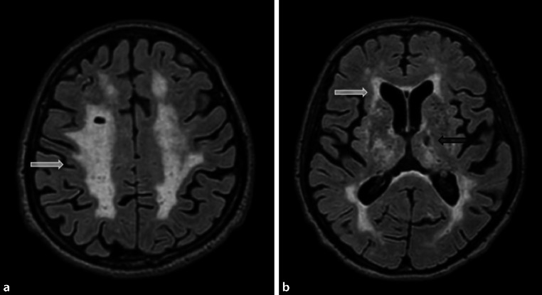 Fig. 10