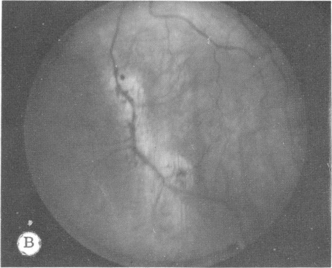 FIGURE 14 B