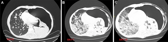 Fig. 1