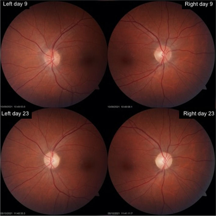 Fig. 2