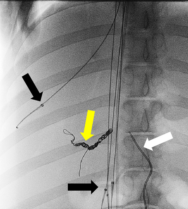 Figure 3b: